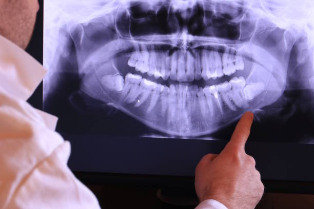 Best Cracked Tooth Emergency Dentist  in Stokesdale, NC